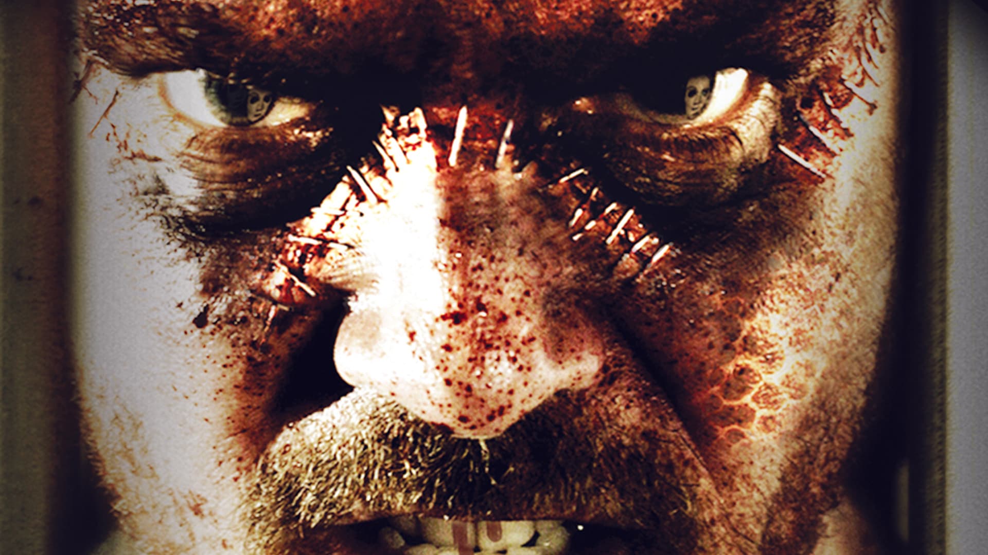 The Frankenstein Syndrome