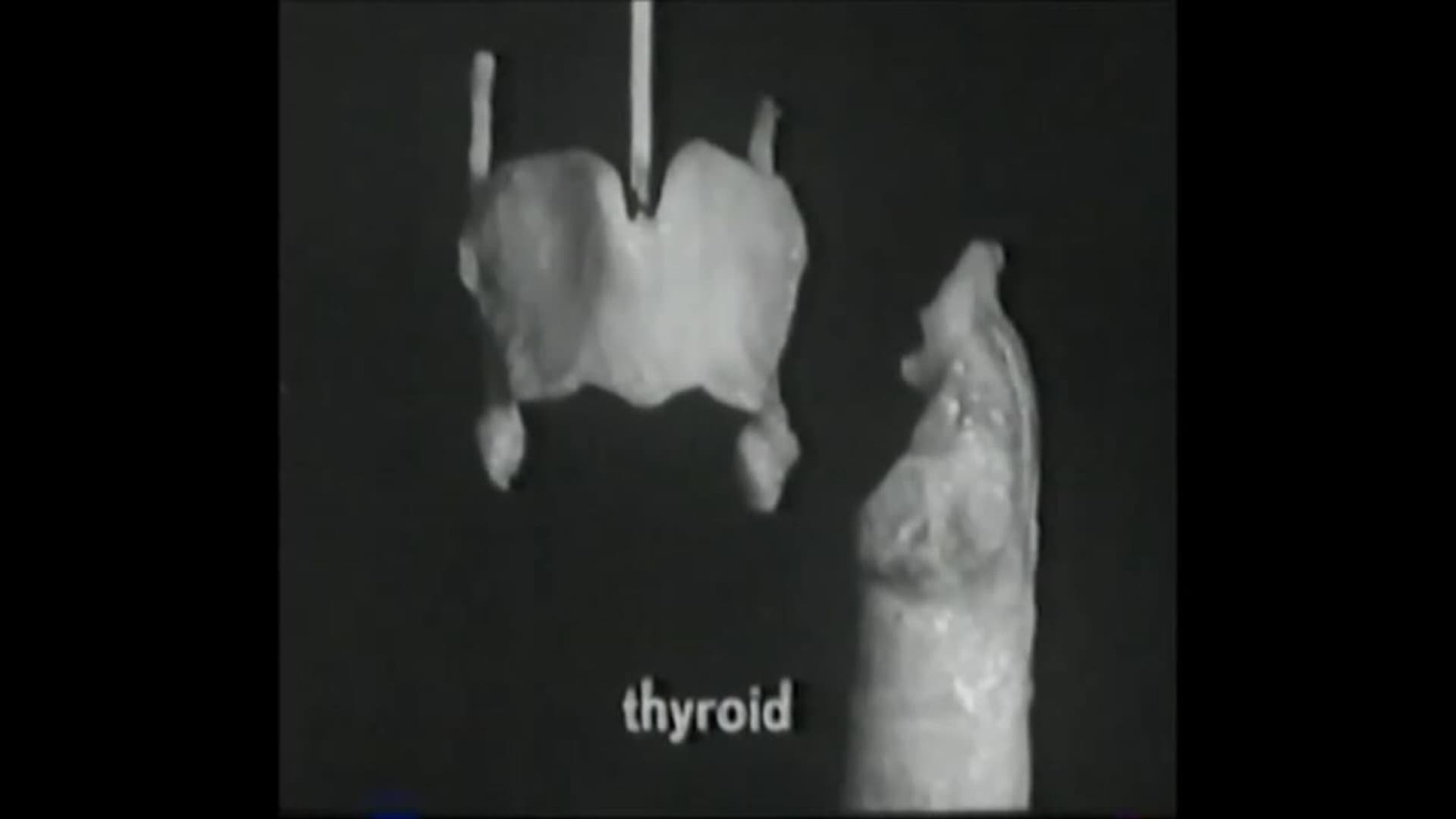 Voice Production: The Vibrating Larynx