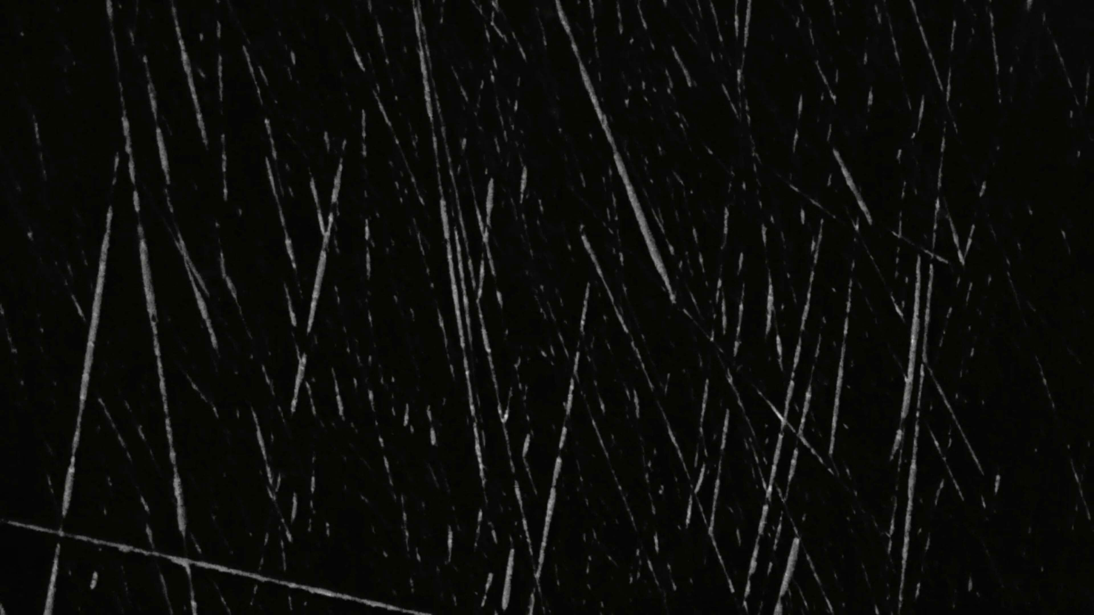 Anomalies (Thrombosis)