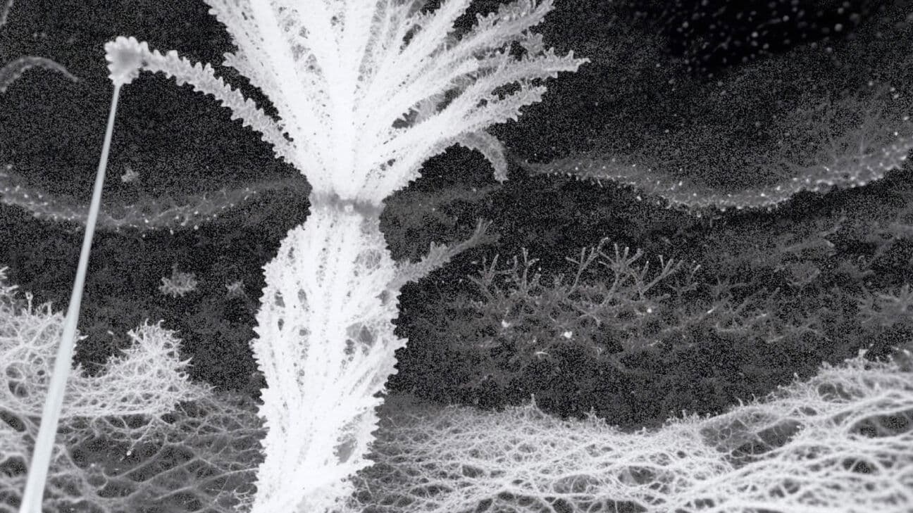 Echoes Between Seeing #3