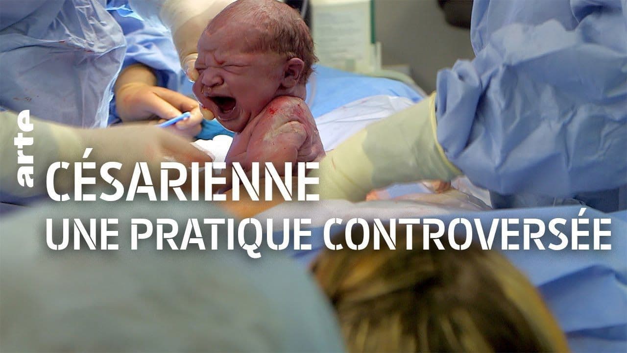 Kaiserschnitt - Die Kontroverse