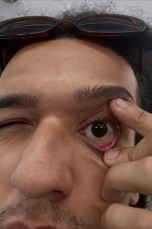 Conceição PH