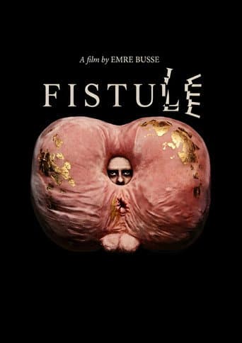 FISTULE