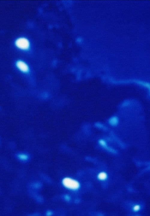 Morfología de un sueño