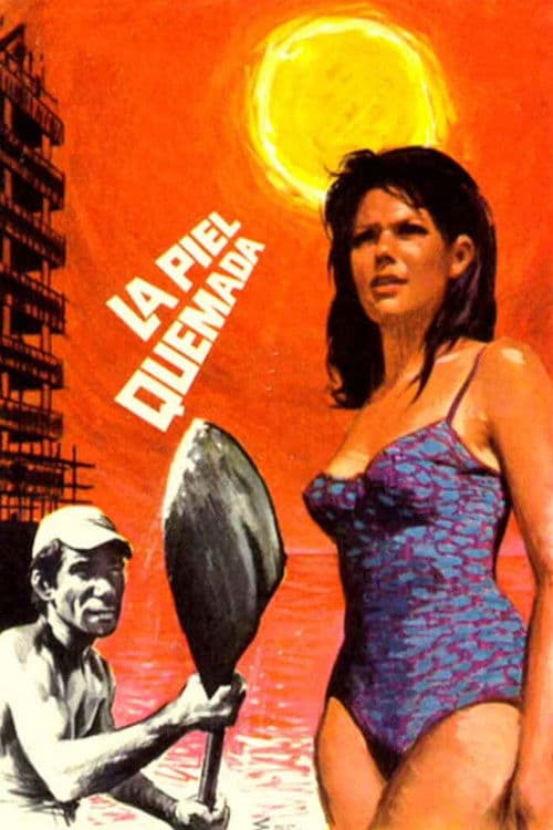 La piel quemada