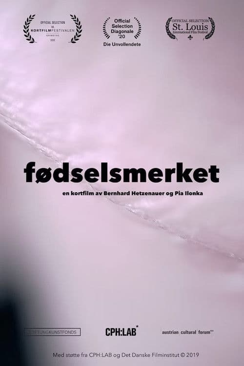 El lunar en su espalda