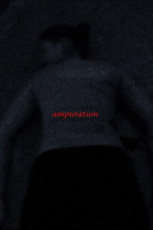 Amputation